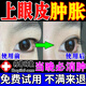 腫眼泡去脂消腫消除眼睛眼部脂肪厚眼皮松弛眼皮浮腫神器緊致眼皮浮腫水腫紅腫脹提拉消脂精油 買二送一【免費試用】發(fā)3盒