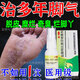 腳氣噴劑腳氣藥止癢脫皮爛腳丫真菌感染腳趾縫潰爛癢開裂水泡腳氣止癢殺菌治腳癬用藥鹽酸特比萘芬噴霧劑 1盒【噴一噴 殺菌止癢】