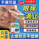 澳福來眼睛癢越揉越癢滴眼液過敏性結(jié)膜炎發(fā)癢抗過敏過敏性結(jié)膜炎兒鼻炎 鼻炎眼睛癢結(jié)膜角膜炎可用 眼睛癢越揉越癢眼藥水