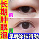 腫眼泡去脂消腫神器眼部脂肪上眼皮松弛消除眼睛熬夜紅腫浮腫眼周干澀水腫C 一盒裝【不劃算