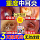 OIMG中耳炎專(zhuān)液用藥滴耳液治療耳道發(fā)炎流膿真菌耳朵癢疼止癢抑菌日本 中耳炎專(zhuān)用滴液