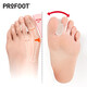 ProFoot拇指外翻分趾器大腳趾頭大拇指大腳骨拇外翻女士可穿鞋姆腳指頭母指趾骨分離成人 兩只裝