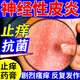 神經(jīng)性皮炎專用藥 止癢藥膏【脖子上長癬】皮膚劇烈瘙癢皮炎濕疹皮膚癬藥膏 皮膚用藥 曲咪新乳膏 2盒裝 胳膊肘皮膚苔蘚狀+可搭配撲爾敏