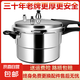 高壓鍋家用防爆燃?xì)饷骰鹈簹鈮毫﹀伡雍裆逃么笕萘靠蛇x電磁爐通用 升級(jí)燃?xì)饷骰鹂?-3人 20cm 4L