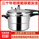 高壓鍋家用防爆燃?xì)饷骰鹈簹鈮毫﹀伡雍裆逃么笕萘靠蛇x電磁爐通用 升級(jí)燃?xì)饷骰鹂?-3人 20cm 4L