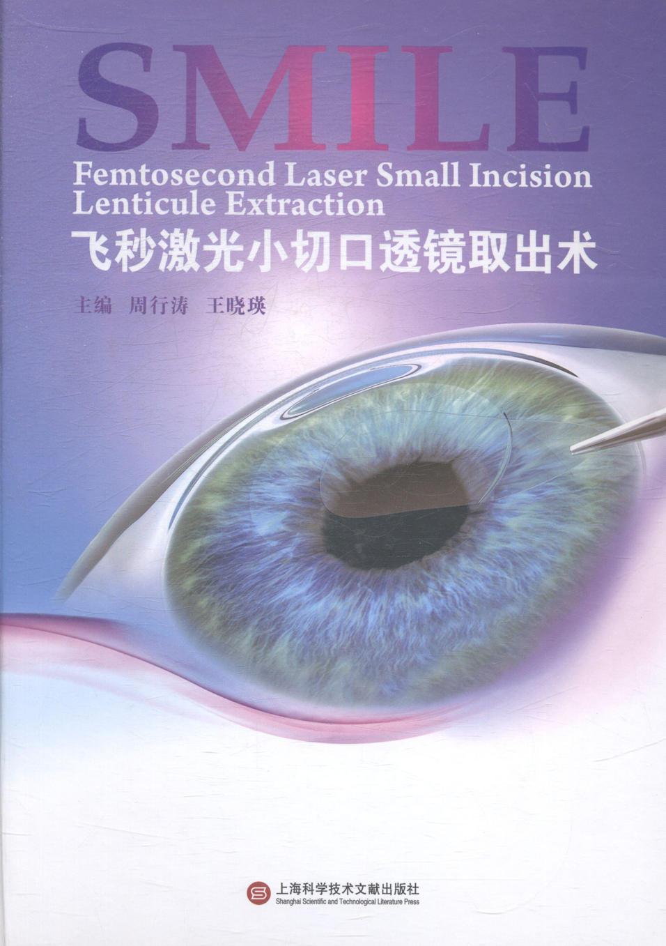 飞秒激光小切口透镜取出术医学近视眼外科手术激光手术图书