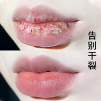 【2支39】凡士林润唇膏女保湿滋润补水唇部护理淡化唇纹防干裂唇膜男女学生口i红修护打底 两支