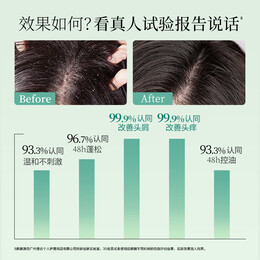 阿道夫祛屑舒爽洗發(fā)水420ml 去屑控油清潔頭皮 精油香氛留香洗發(fā)乳液