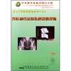 

脊柱和骨盆损伤影像诊断（DVD）