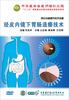 

经皮内镜下胃肠造瘘术DVD