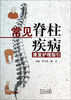 

常见脊柱疾病康复护理指引