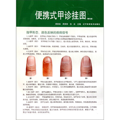 

便携式甲诊挂图（附光盘1张）