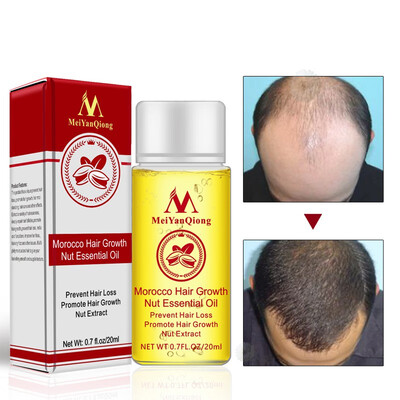 

Hair Loss Products Fast Powerful Hair Growth Essence Essential Oil Liquid Treatment Preventing Hair Loss Hair Care