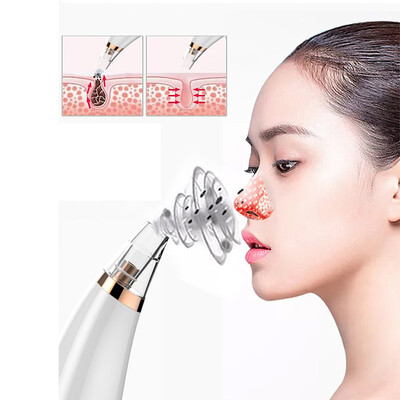 

〖Follure〗Blackhead Remover Vacuum Facial Acne Pore Cleaner Electronic Come done Blackhead