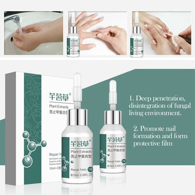 

Anti-Fungal Nail Treatment Liquid Anti-fungal Plant Extracts Onychomycosis And Paronychia Repair Liquid Nail Protector