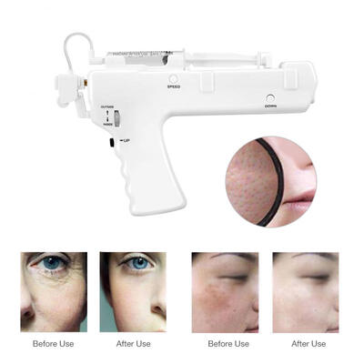 

Greensen Vanadium Titanium Beauty Instrument Mesotherapy Gun Skin Rejuvenation Wrinkle Removal Mesogun