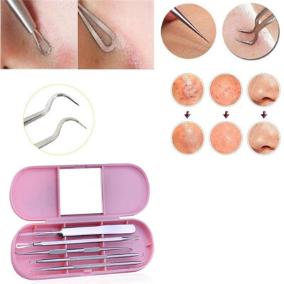 

〖Follure〗Stainless Facial Acne Spot Pimple Remover Extractor Tool Comedone