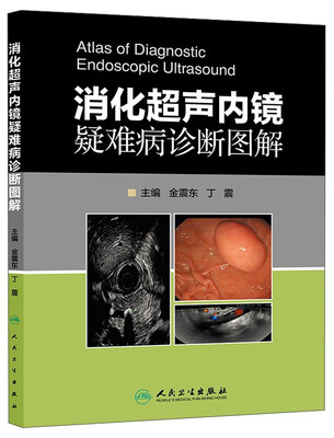 

消化超声内镜疑难病诊断图解