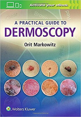 

A Practical Guide to Dermoscopy