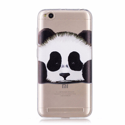 

For Xiaomi Redmi 5A Cases Cute Pattern Xiomi Redmi 5A Silicone Soft Cover