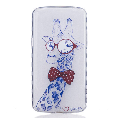 

Giraffe Pattern Soft Thin TPU Rubber Silicone Gel Case Cover for LG K5