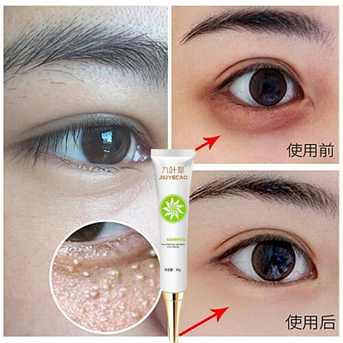 眼霜去脂肪粒淡化黑眼圈眼袋细纹滋润补水保湿抗皱修复紧致眼部精华30g