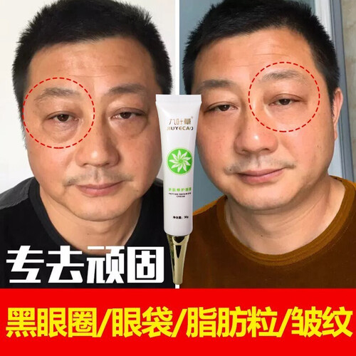 正品眼霜去细纹提拉紧致男女士淡化脂肪粒黑眼圈眼袋皱纹鱼尾纹紧致眼部浮肿补水精华