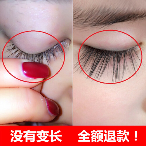 睫毛增长液眼睫毛眉毛生长液眉滋养精华液防水浓密纤长卷翘生长液