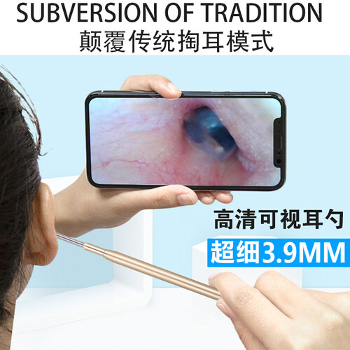 3.9mm可视挖耳勺掏耳神器发光高清掏耳朵采耳屎工具套装带灯掏耳勺挖耳朵儿童宝宝抖音同款小孩成人 3.9mm高清【电脑版】优雅蓝