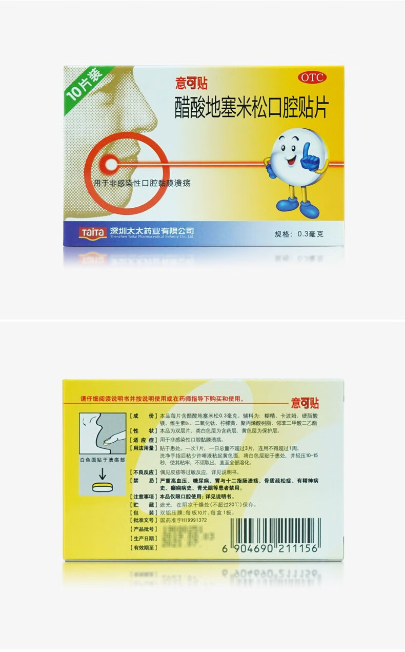 意可贴 醋酸地塞米松口腔贴片10片 口腔溃疡贴膏片 用于儿童成人 非
