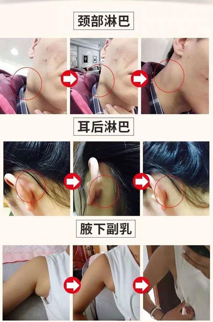 白云通晓堂淋巴贴新华通晓堂长木通晓堂通晓堂淋巴贴白木通晓堂青木通