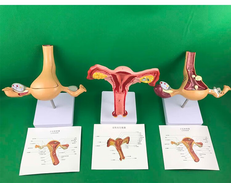 人体子宫模型教具模具卵巢解剖病理医学女性仿真女性生殖模器b款双侧