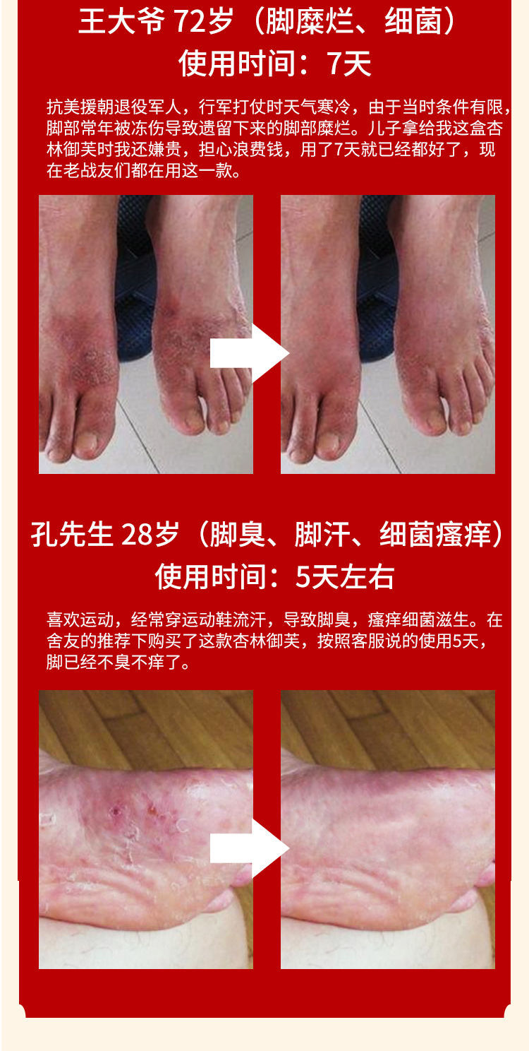 脚臭的原因和治疗方法_原因治疗脚臭方法图片_怎么治疗脚臭最管用