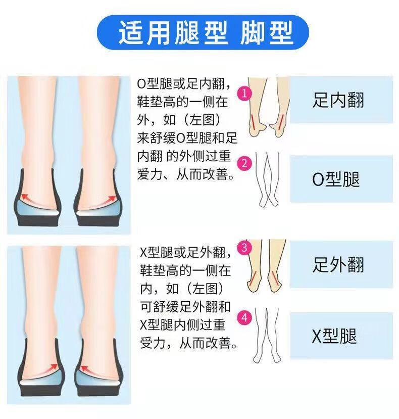 pggo型腿腿型直腿鞋垫o型xo型x型腿器小腿外翻纠正3代双磁款20倍矫正7