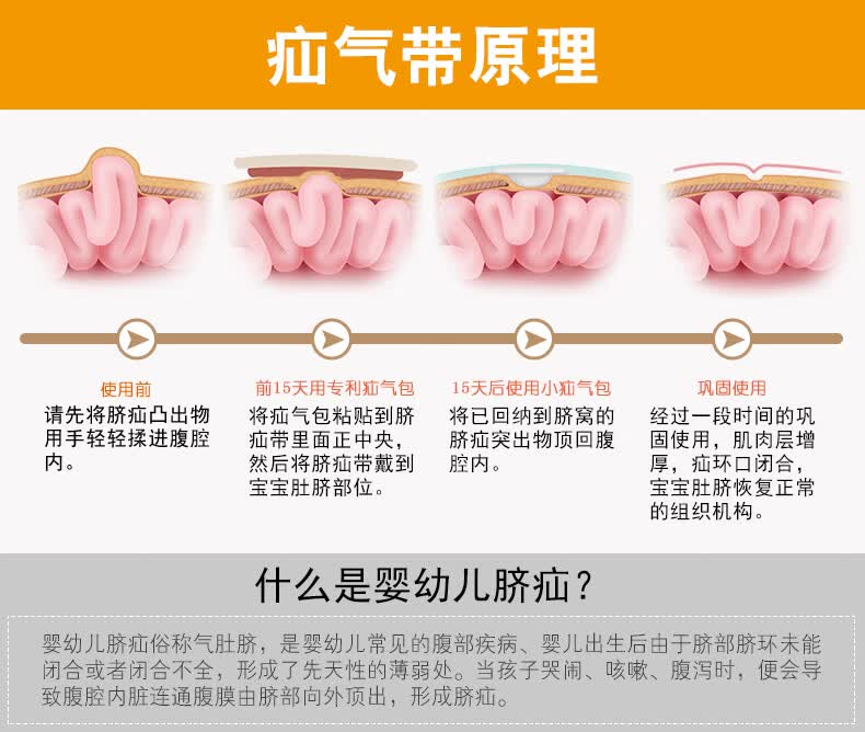 鸿竹 脐疝带医用疝气带脐疝贴婴儿脐疝袋婴幼儿新生儿凸肚脐宝宝肚脐