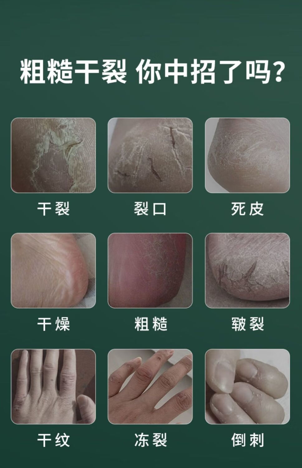 护足霜足裂膏脚后跟手脚干裂去死皮老茧修护霜皲裂膏防冻修复粗糙脱皮