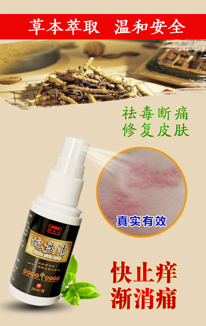 药带状后遗症神经痛止痛病毒蛇盘疮药蛇盘清 1瓶蛇盘清送涂抹乳膏一支