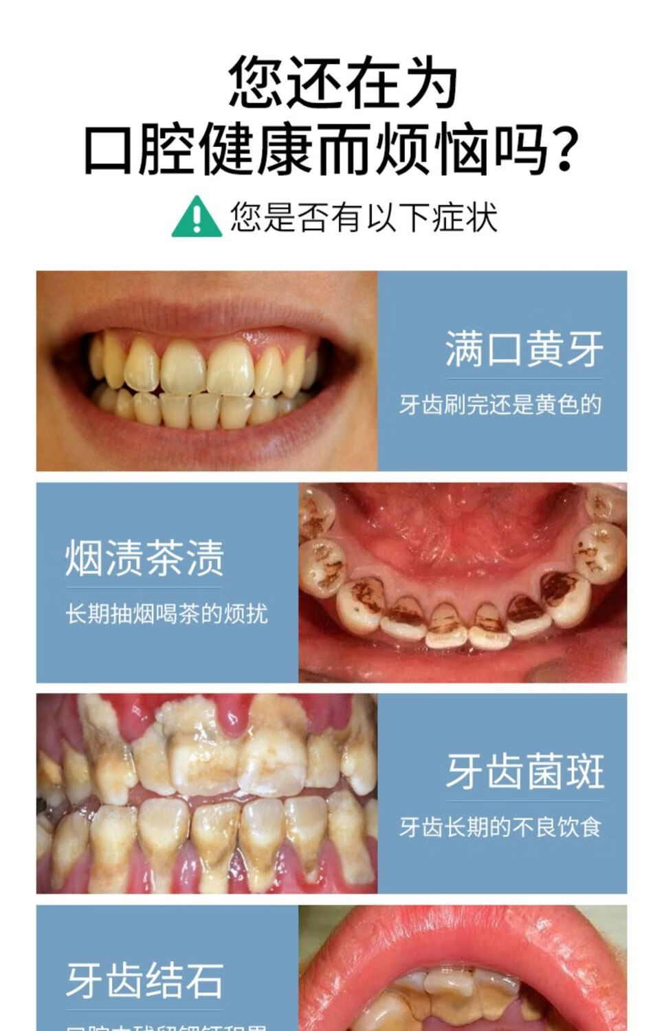 旦榄家用牙结石去除器声波去除牙垢牙结石清理器洗牙器牙结石神器靛蓝