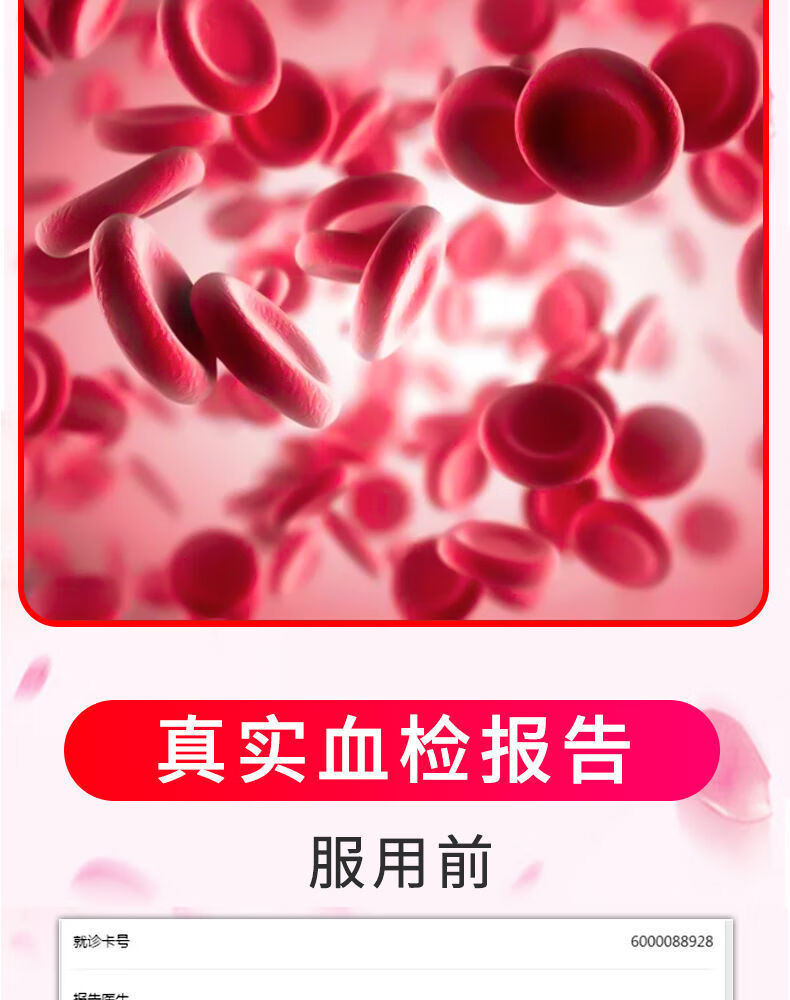 氯化高铁血红素胶囊图片