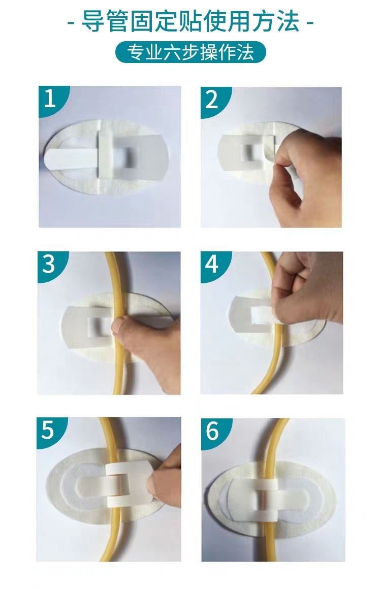 innomed隆泰导管固定敷料导管固定贴picc导尿管鼻饲鼻氧管固定贴隆泰