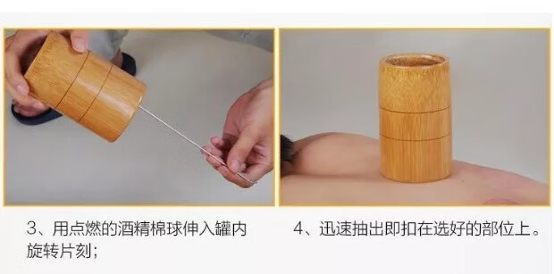 拔罐家用套装碳化竹子竹筒竹罐拔火罐竹罐拔罐木罐大中小号家用套装10