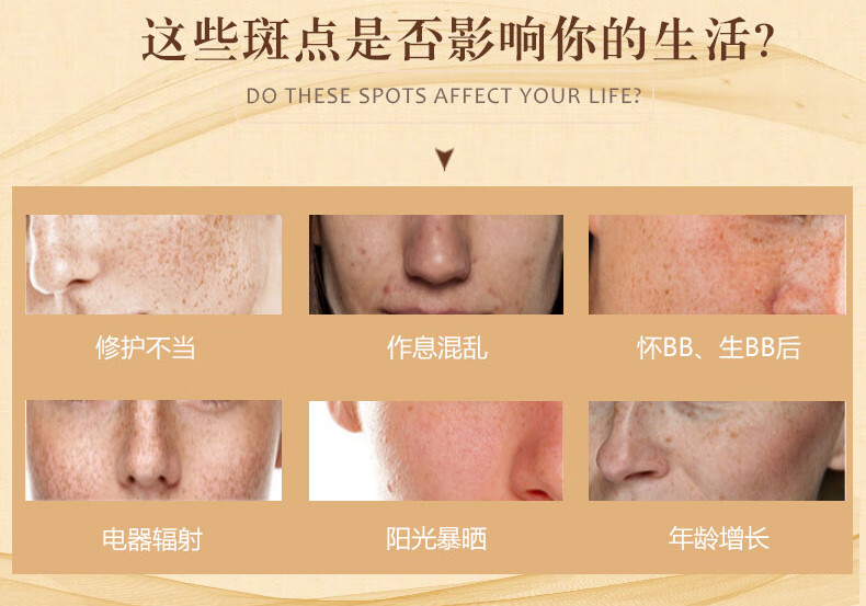 黑斑色素斑日晒斑老年斑素颜洗面奶保湿补水面霜脸部护肤产品买2送5