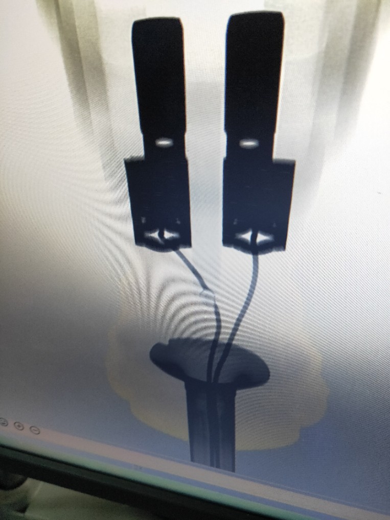 骨科透视仪x光家用高清工业检测x光机探伤x射线机宠物 便携式x光机