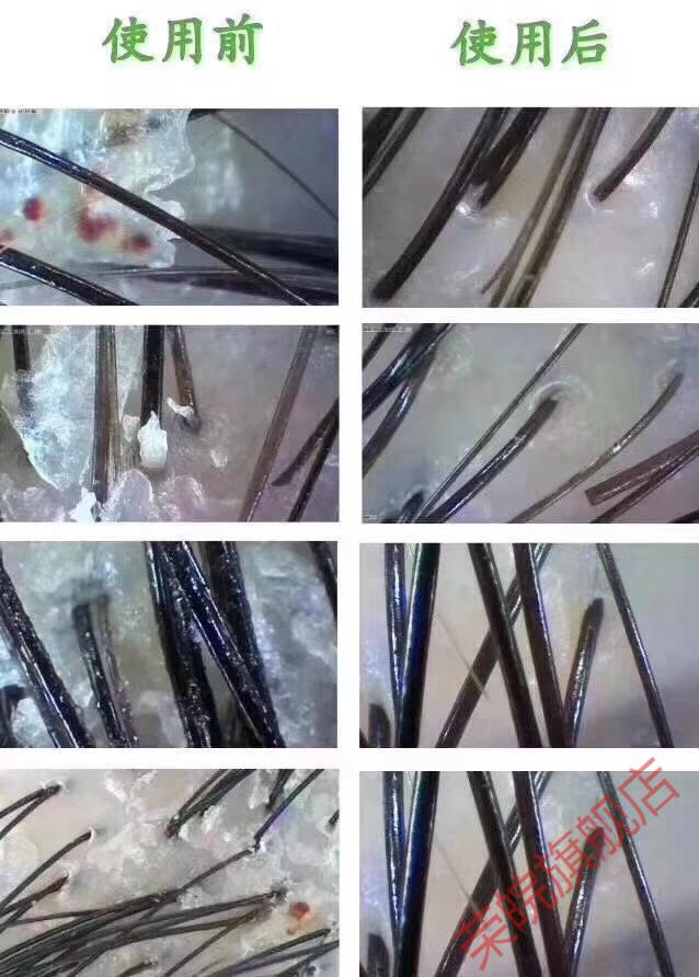 艾文头皮检测仪高清理发店毛囊毛发仪器皮肤检测分析带双镜头八核四谱