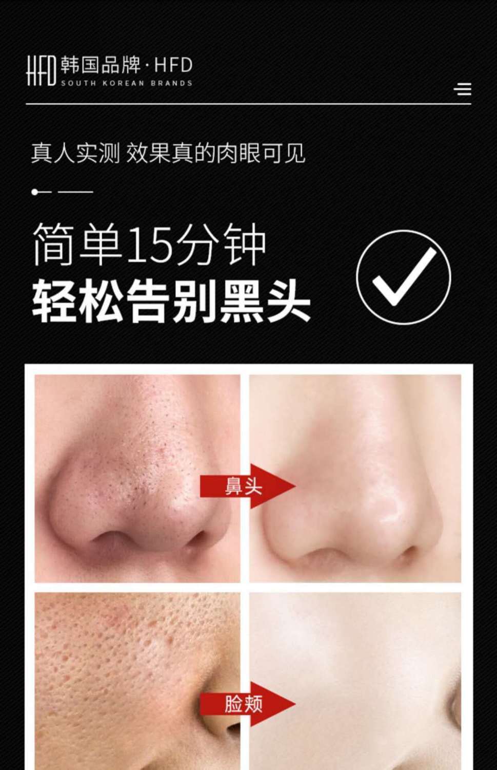 去黑鼻头 hfd去黑头导出精华液套装美容院闭口粉刺草莓鼻毛孔粗大收缩