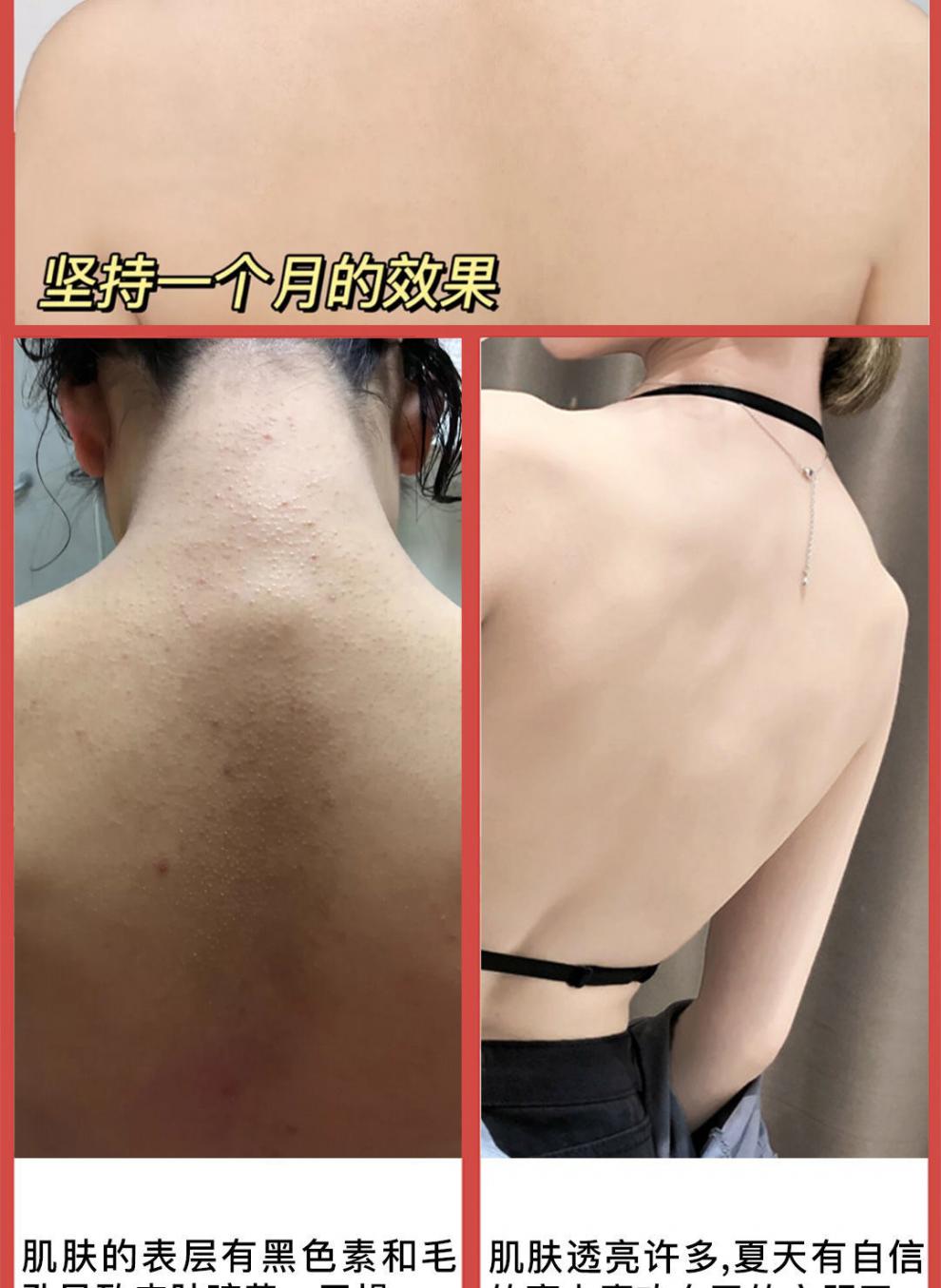 孕妇经常起鸡皮疙瘩为什么(孕妇经常起鸡皮疙瘩为什么会痒)