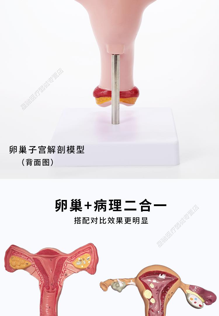 人体子宫附件模型女性医学生殖器卵巢病理病变结构解剖教学具娇之乐