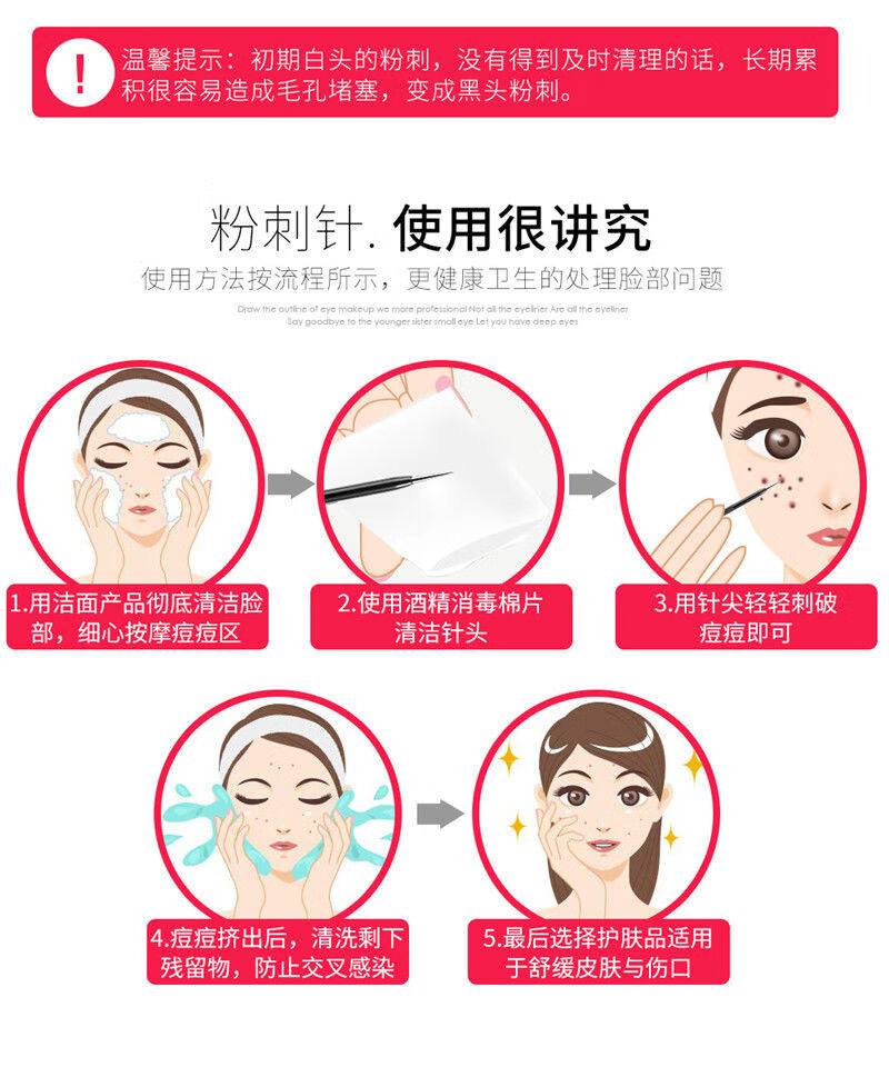 美道 粉刺针去黑头针 挑痘针 暗疮针祛痘美容针 挤痘痘镊子细胞夹套装 银色粉刺针2支装