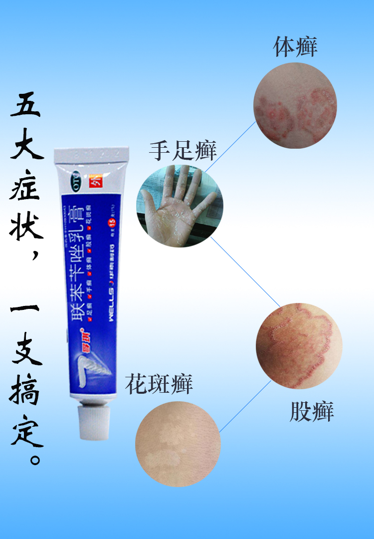 孚琪 联苯苄唑乳膏 15g 手癣 体癣 足癣 花斑癣 1盒