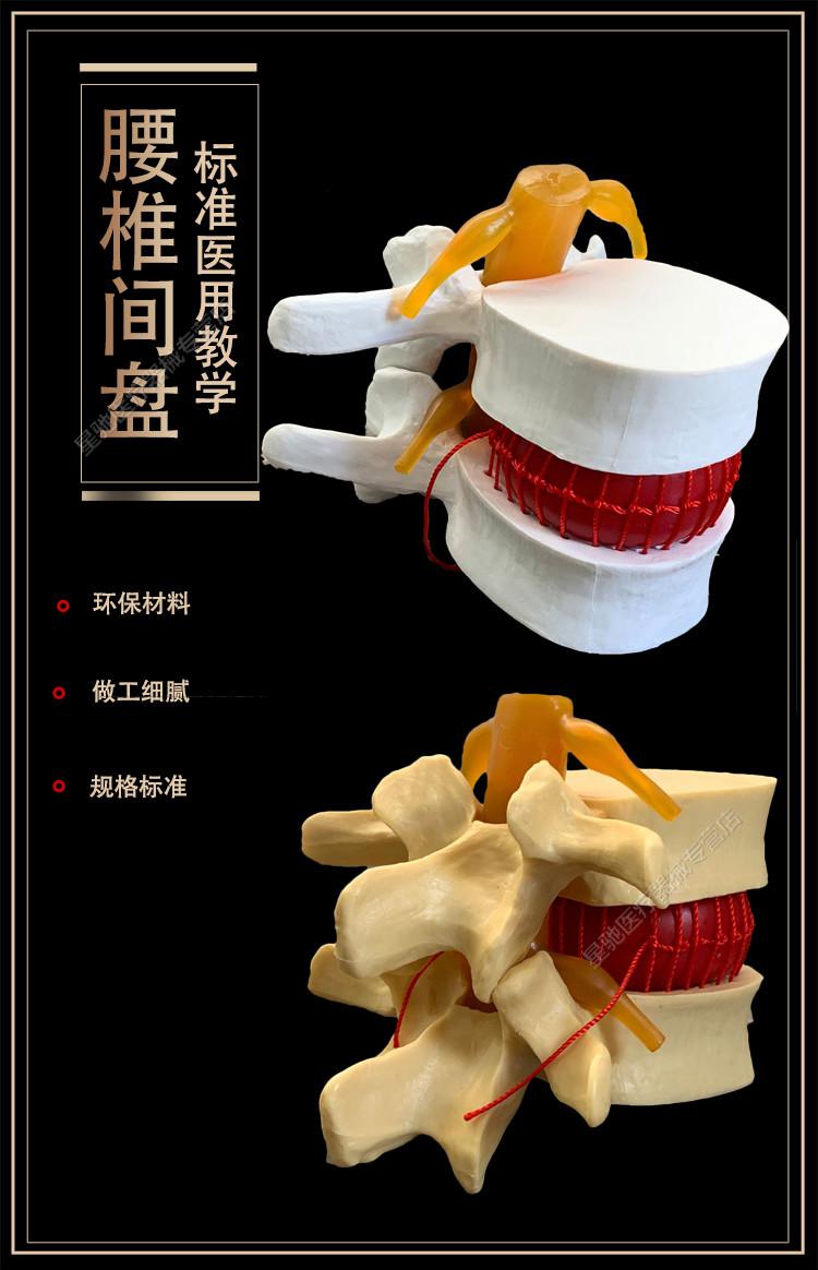 人体腰椎间盘演示模型腰椎模型脊柱模型脊椎模型关节模型娇之乐姜黄色